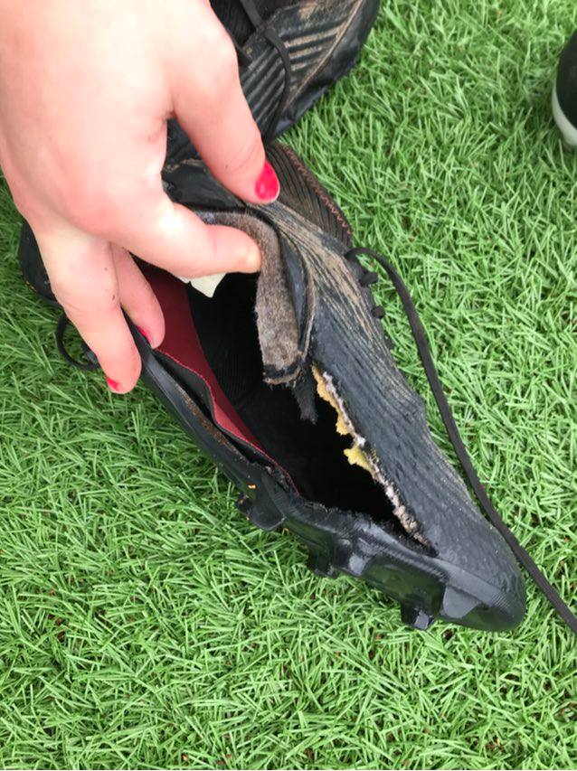 La Chaussure de Cassandre n'a pas apprécié le synthétique du Nantes SC